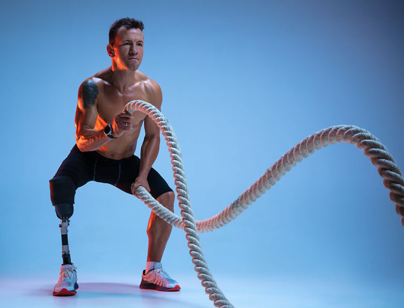 Melhor lugar para fazer protese em belo horizonte