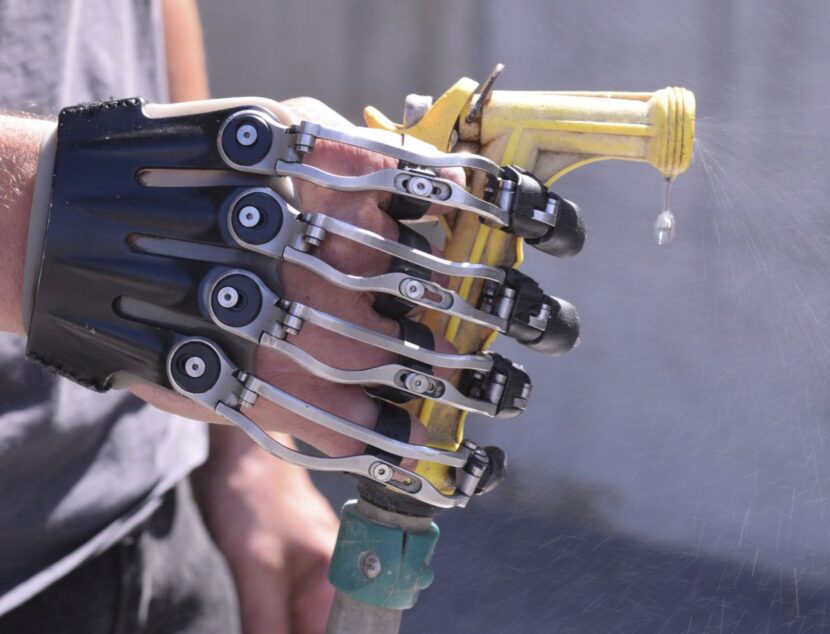 Reabilitação com prótese de mãos e dedos como recuperar a função da mão e voltar a usar no dia a dia