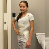 qual posição quem tem escoliose deve dormir