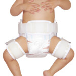 Ortese Pediatrica de Abducao de quadril