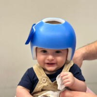 Agosto Dourado Assimetria Craniana